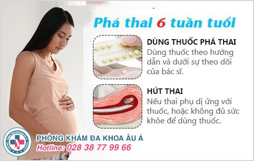 phá thai 6 tuần