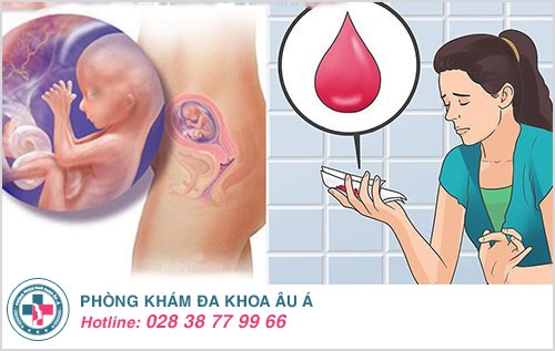 Ra máu, dịch màu hồng - dấu hiệu dọa sảy thai dễ nhận biết Ra máu, dịch màu hồng - dấu hiệu dọa sảy thai dễ nhận biết
