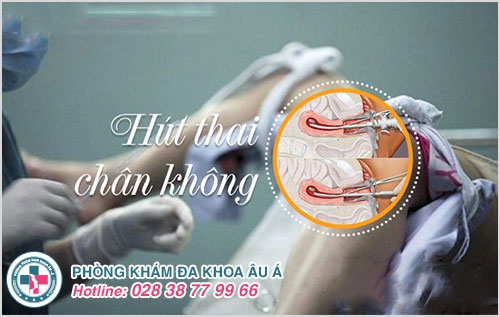 Hút thai theo tháng Hút thai theo tháng