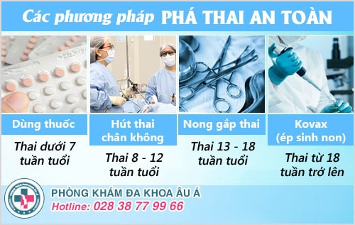 Bác sĩ tư vấn thời điểm phá thai an toàn Bác sĩ tư vấn thời điểm phá thai an toàn