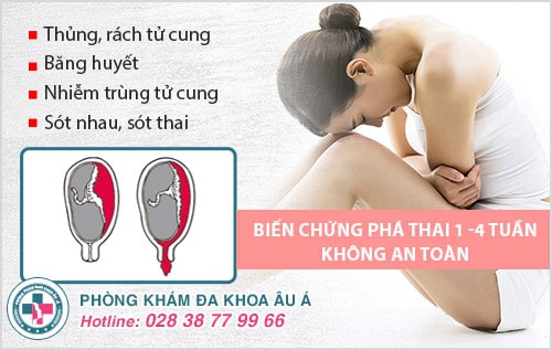 Phá thai 13 tuần bằng phương pháp nào? Có nguy hiểm không? Phá thai 13 tuần bằng phương pháp nào? Có nguy hiểm không?