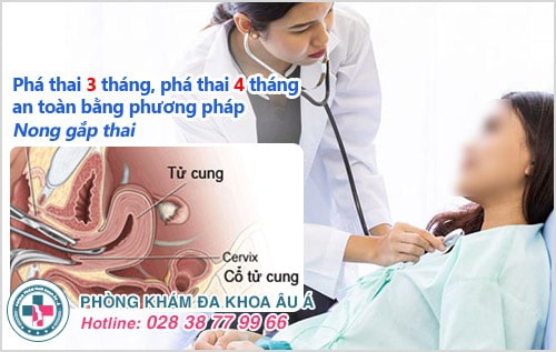 Bỏ thai lớn có ảnh hưởng gì không? Phương pháp bỏ thai 3, 4, 5 tháng an toàn Bỏ thai lớn có ảnh hưởng gì không? Phương pháp bỏ thai 3, 4, 5 tháng an toàn