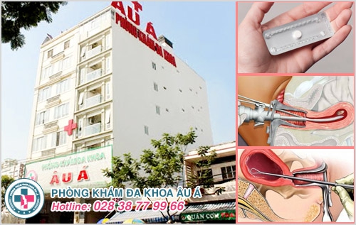 Những thông tin liên quan đến hút thai chân không chị em nên biết Những thông tin liên quan đến hút thai chân không chị em nên biết