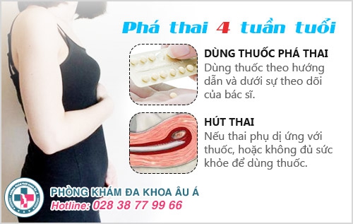 Phá thai 4 tuần có tội không? Phá thai 4 tuần có tội không?