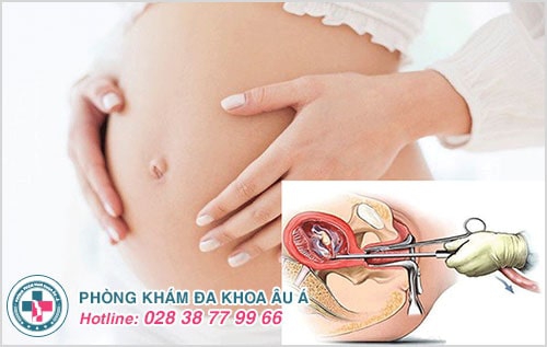Phá thai theo tuần, áp dụng đúng phương pháp tránh biến chứng Phá thai theo tuần, áp dụng đúng phương pháp tránh biến chứng