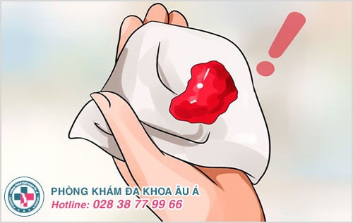 Sót thai, sót nhau sau phá thai: hệ lụy nguy hiểm và cách xử lý Sót thai, sót nhau sau phá thai: hệ lụy nguy hiểm và cách xử lý