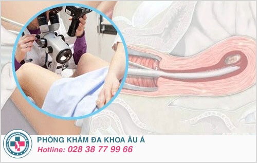 phá thai 10 tuần phá thai 10 tuần