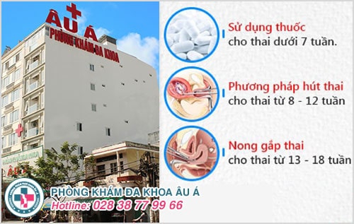 Phá thai 15 tuần có được không? Phá thai 15 tuần có được không?