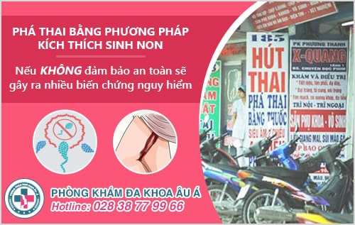 Phá thai bằng phương pháp kích thích sinh non là như thế nào? Phá thai bằng phương pháp kích thích sinh non là như thế nào?