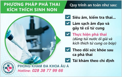 Phá thai bằng phương pháp kích thích sinh non là như thế nào? Phá thai bằng phương pháp kích thích sinh non là như thế nào?