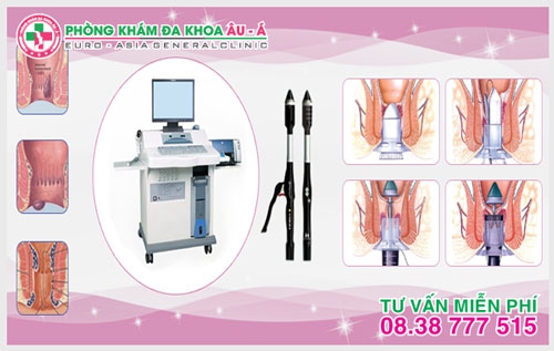 Cách hỗ trợ điều trị bệnh trĩ nội và trĩ ngoại hiệu quả