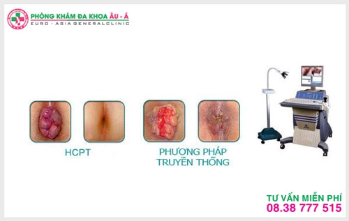 hỗ trợ điều trị trĩ ngoại hiệu quả ở đâu tại TPHCM
