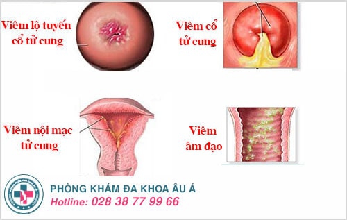 chậm kinh ra máu nâu chậm kinh ra máu nâu